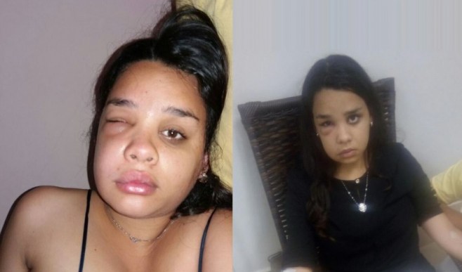Jovem tem grave infecÃ§Ã£o apÃ³s tratamento; clÃ­nica coloca culpa em paciente